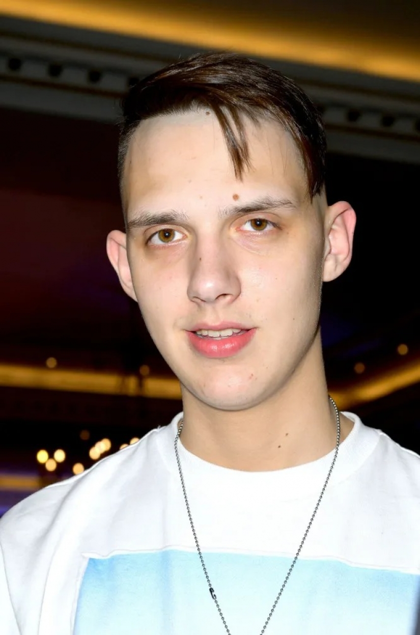 Envejecido: cómo se verá Buzova, Barskikh, Loboda y otras estrellas en la jubilación