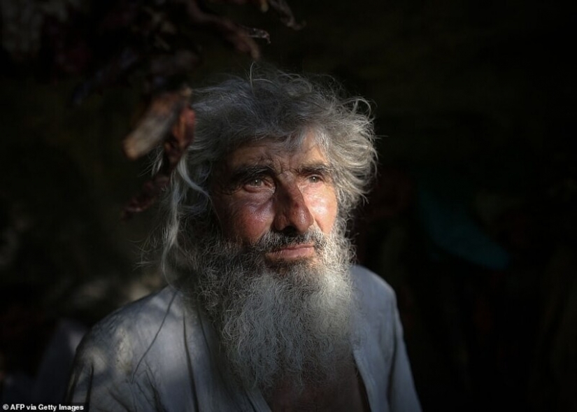 Ermitaño serbio de 70 años salió a vacunarse