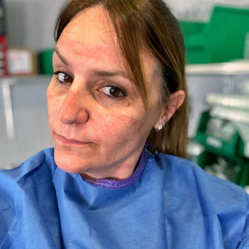 "Estas heridas no desaparecerán, permanecerán dentro de nosotros": fotos de chicas médicas con rastros de máscaras en sus rostros "Estas heridas no desaparecerán, permanecerán dentro de nosotros": fotos de chicas médicas con rastros de máscaras en sus rostros