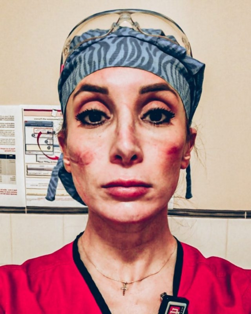 "Estas heridas no desaparecerán, permanecerán dentro de nosotros": fotos de chicas médicas con rastros de máscaras en sus rostros "Estas heridas no desaparecerán, permanecerán dentro de nosotros": fotos de chicas médicas con rastros de máscaras en sus rostros