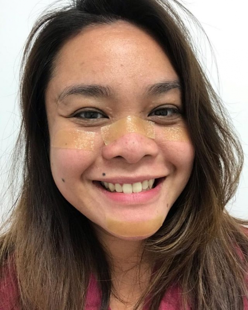 "Estas heridas no desaparecerán, permanecerán dentro de nosotros": fotos de chicas médicas con rastros de máscaras en sus rostros "Estas heridas no desaparecerán, permanecerán dentro de nosotros": fotos de chicas médicas con rastros de máscaras en sus rostros