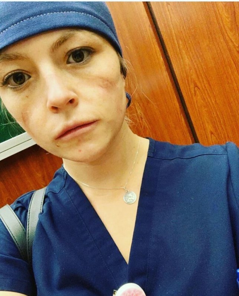 "Estas heridas no desaparecerán, permanecerán dentro de nosotros": fotos de chicas médicas con rastros de máscaras en sus rostros "Estas heridas no desaparecerán, permanecerán dentro de nosotros": fotos de chicas médicas con rastros de máscaras en sus rostros