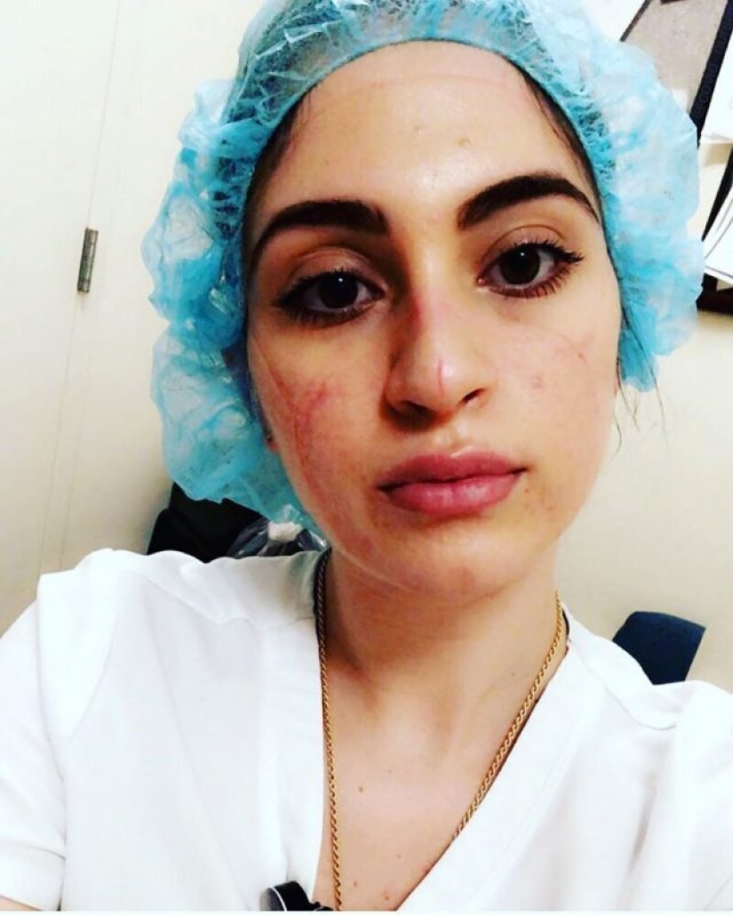 "Estas heridas no desaparecerán, permanecerán dentro de nosotros": fotos de chicas médicas con rastros de máscaras en sus rostros "Estas heridas no desaparecerán, permanecerán dentro de nosotros": fotos de chicas médicas con rastros de máscaras en sus rostros