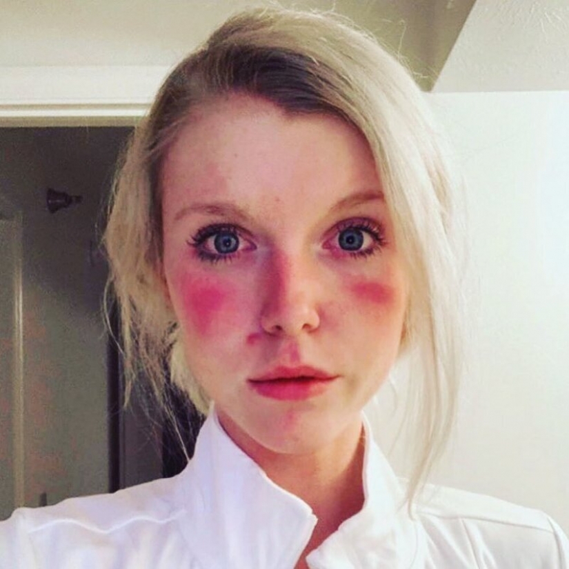 "Estas heridas no desaparecerán, permanecerán dentro de nosotros": fotos de chicas médicas con rastros de máscaras en sus rostros "Estas heridas no desaparecerán, permanecerán dentro de nosotros": fotos de chicas médicas con rastros de máscaras en sus rostros