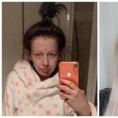 From a frog to a princess: a former drug addict became a beauty, getting rid of addiction