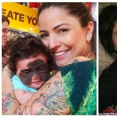 From Batman to Princess: Russian doctors removed a huge birthmark from the face of a 2-year-old American woman