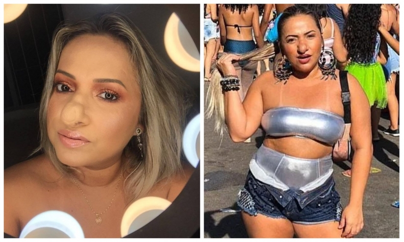 "Go away, Pinocchio!": a Brazilian woman has learned to love herself, despite a huge nose "Go away, Pinocchio!": a Brazilian woman has learned to love herself, despite a huge nose