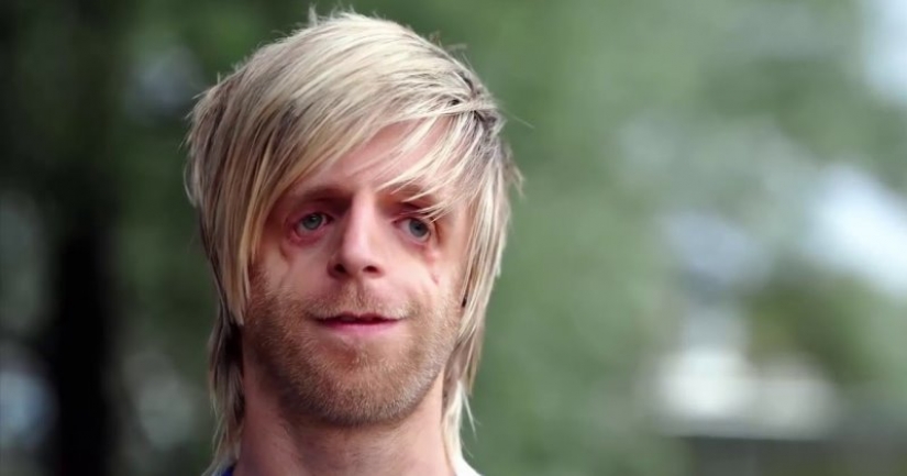 His mother got scared and left him in the hospital, but he grew up and became a success