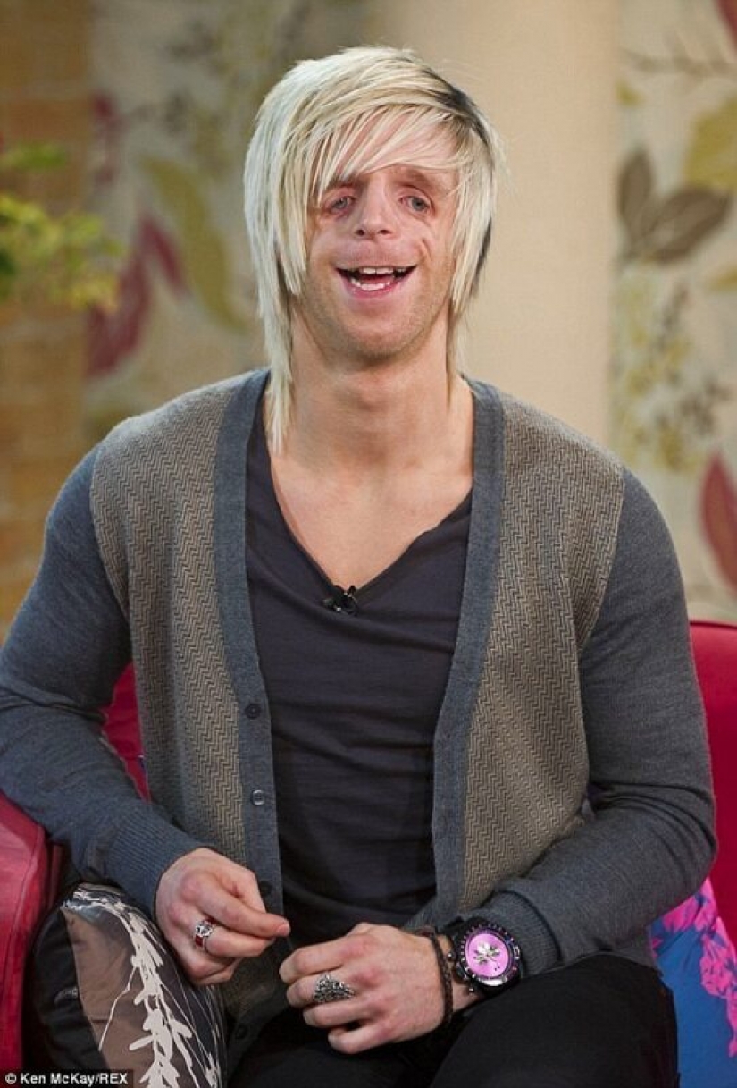 His mother got scared and left him in the hospital, but he grew up and became a success