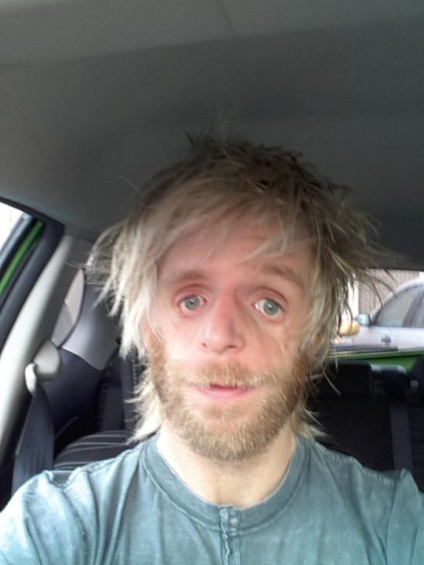 His mother got scared and left him in the hospital, but he grew up and became a success