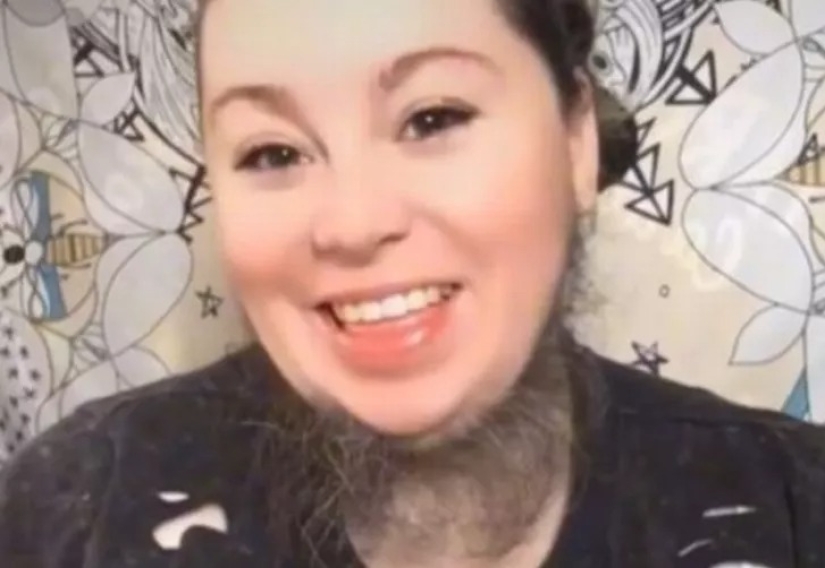 Hottabych, ¿eres tú? ¿Por qué una chica con barba está orgullosa de su vello facial grueso