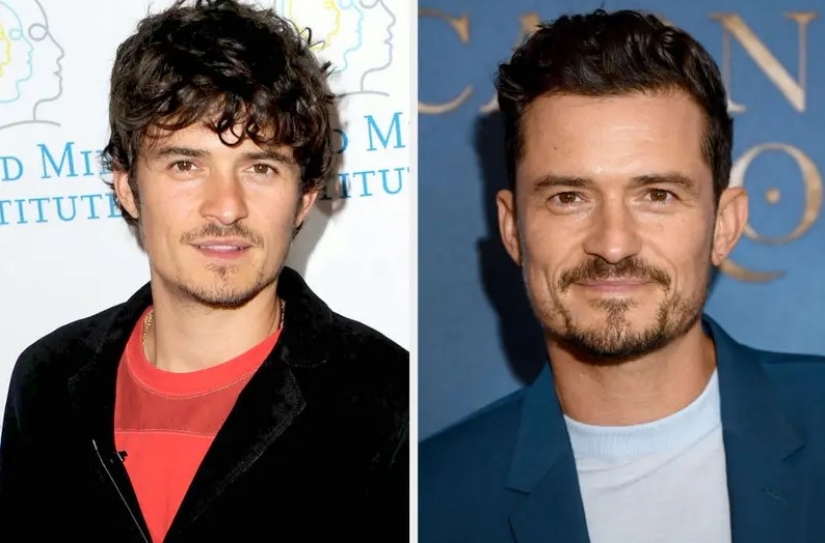 How celebrities have changed in the last 10 years