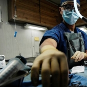 In the USA, surgeons removed a tooth that grew in a man's nose