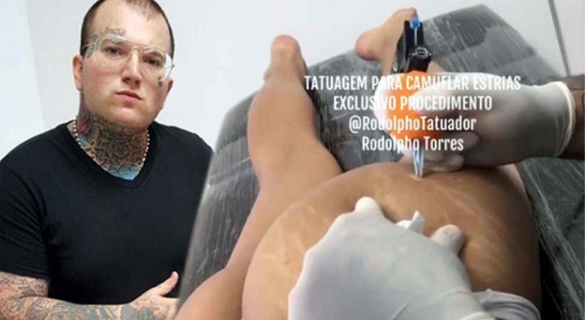 Instead of surgeons and creams: a Brazilian tattoo artist gets rid of stretch marks in an unconventional way