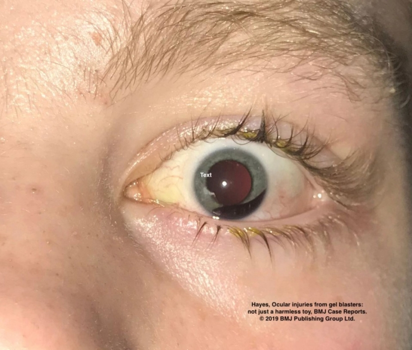 Juegos mortales: 10 juguetes más peligrosos e insalubres de los niños