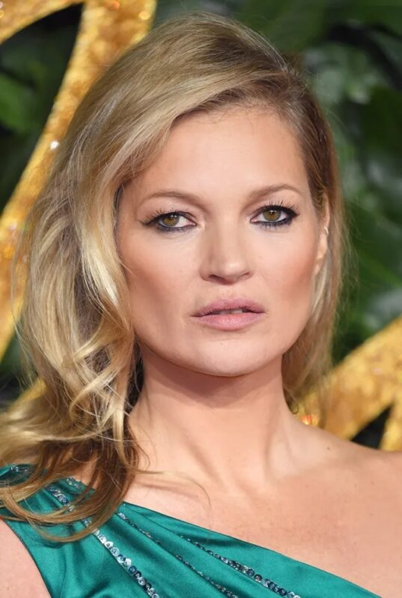 Kate Moss's Squint and 7 more features that the stars don't hide from us