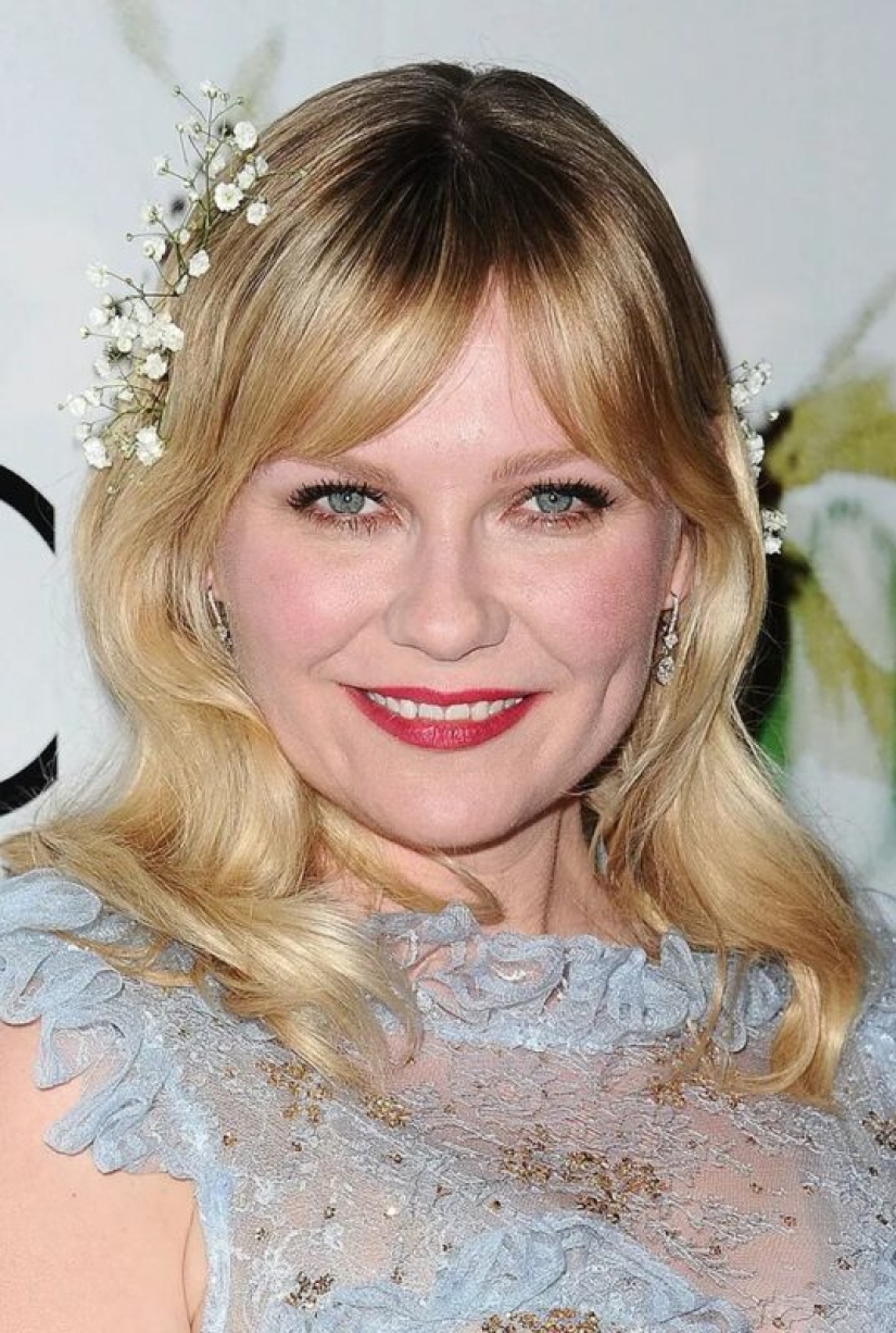 Kate Moss's Squint and 7 more features that the stars don't hide from us