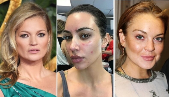 Kate Moss's Squint and 7 more features that the stars don't hide from us