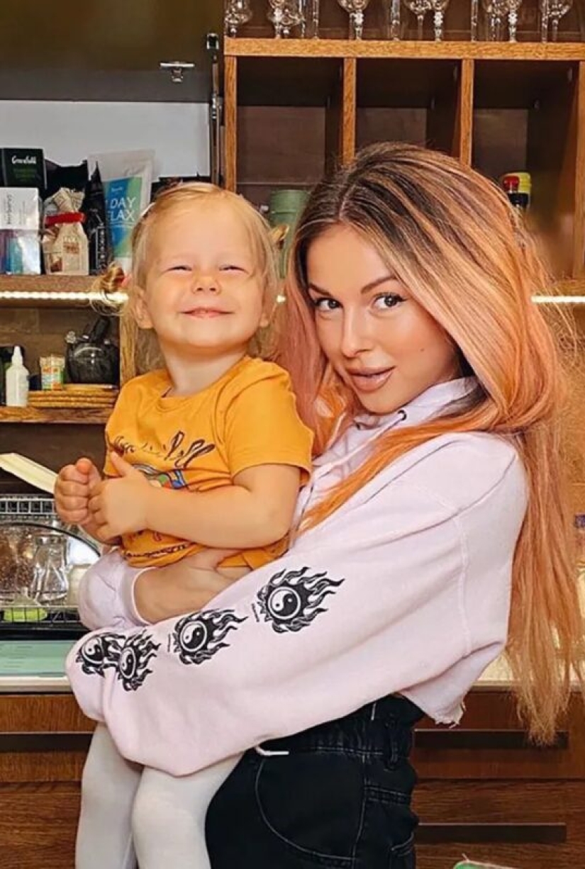 Kate Moss's Squint and 7 more features that the stars don't hide from us