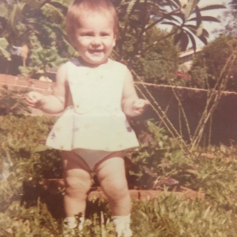 La belleza, no importa qué: una mujer Brasileña con una enfermedad rara admira la auto-confianza