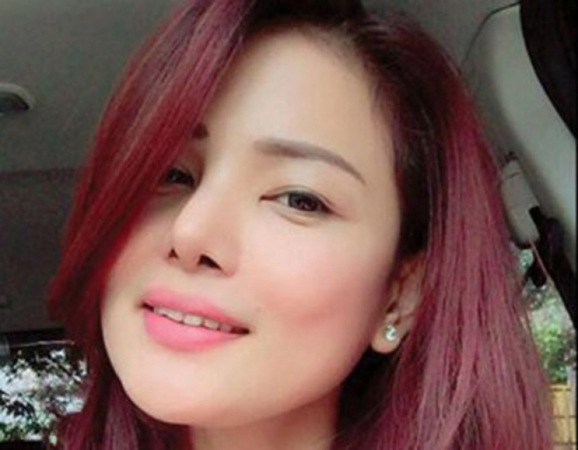 La belleza requiere: 8 víctimas de cirugía plástica