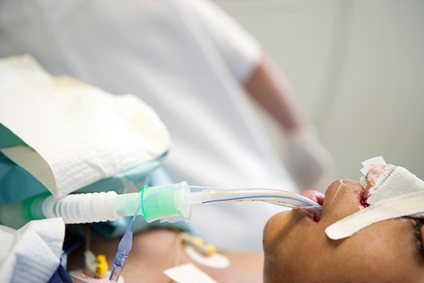 La belleza requiere: 8 víctimas de cirugía plástica