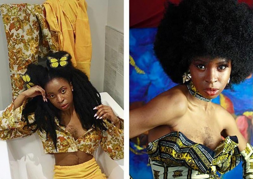 La chica con pelo en el pecho tomó a mí mismo por lo que soy y feliz La chica con pelo en el pecho tomó a mí mismo por lo que soy y feliz