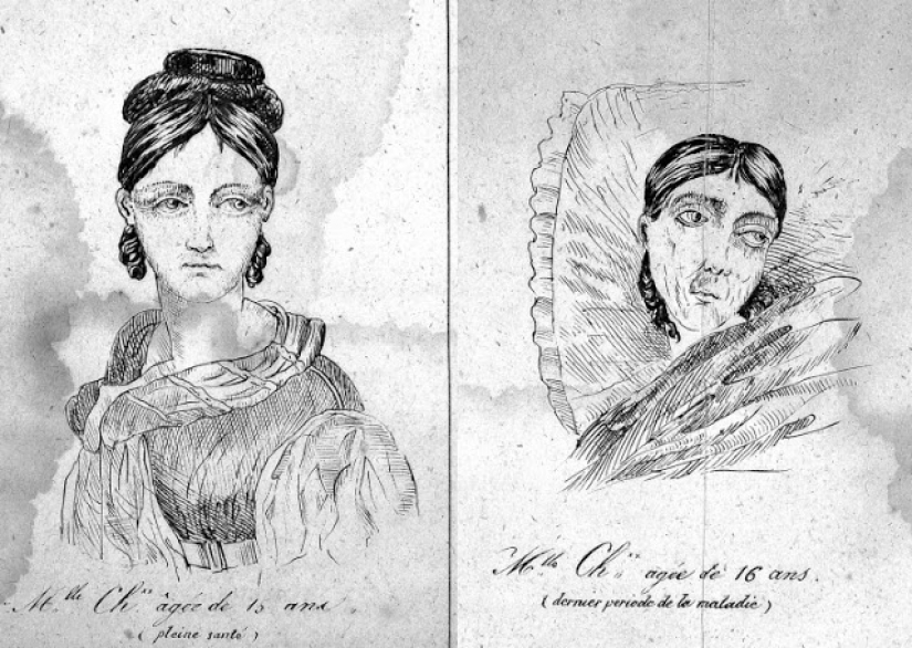 La cura para todas las enfermedades: la circuncisión de la mujer en la Inglaterra Victoriana