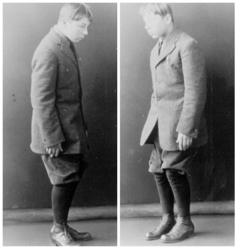 La epidemia de la Enfermedad del Sueño: una extraña enfermedad que convirtió a la gente en zombis vivos