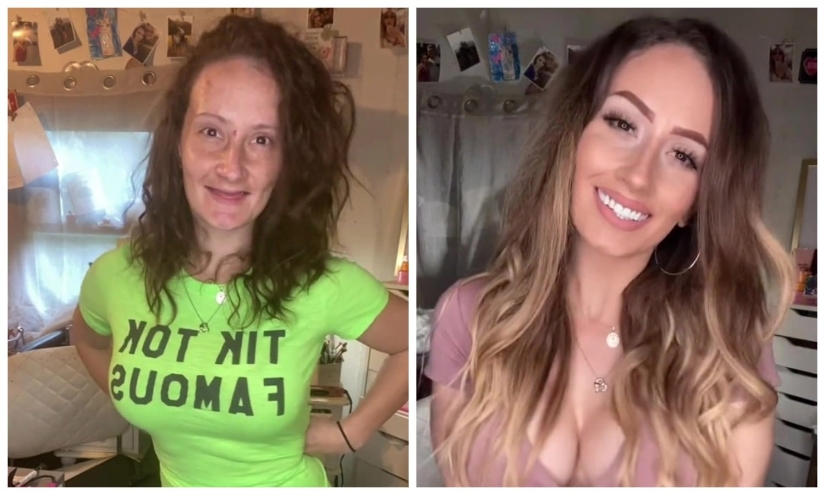 La estadounidense perdió todos sus dientes a la edad de 21 años, pero se mantuvo confiada, gracias a su marido