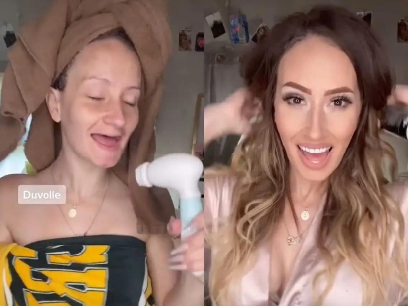 La estadounidense perdió todos sus dientes a la edad de 21 años, pero se mantuvo confiada, gracias a su marido