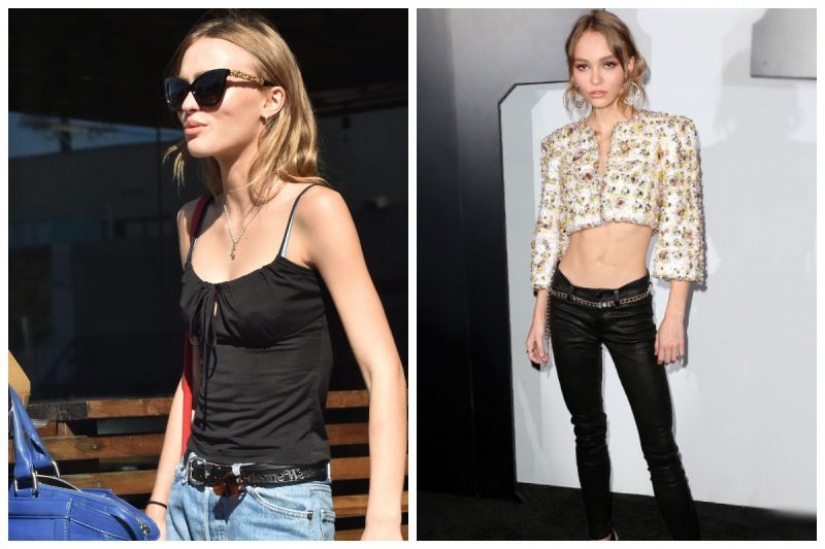 La estrella de la fiebre: el que las celebridades se enfrentan con la anorexia