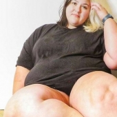 La mujer británica se agotó con dietas para hacer que sus piernas perdieran peso, pero era una enfermedad