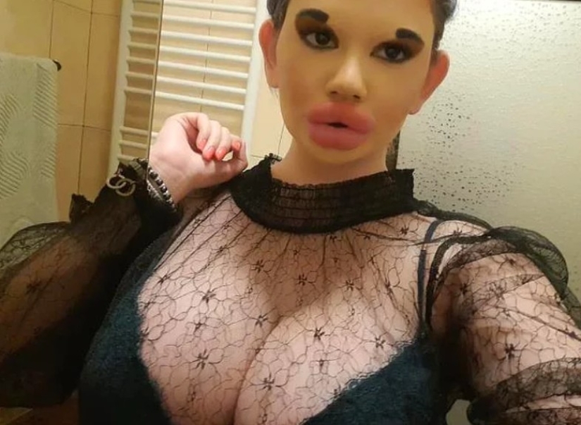 La mujer con los labios más grandes del mundo va a agrandar sus mejillas