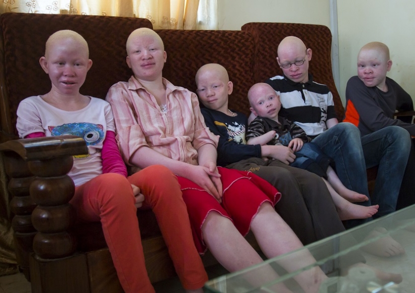 Los albinos de tanzania, cuyos cuerpos valen más que el oro