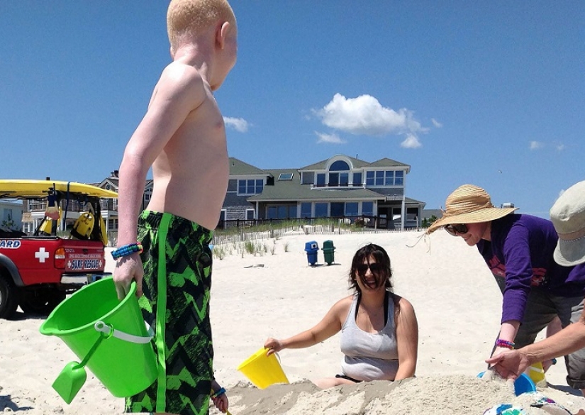 Los albinos de tanzania, cuyos cuerpos valen más que el oro