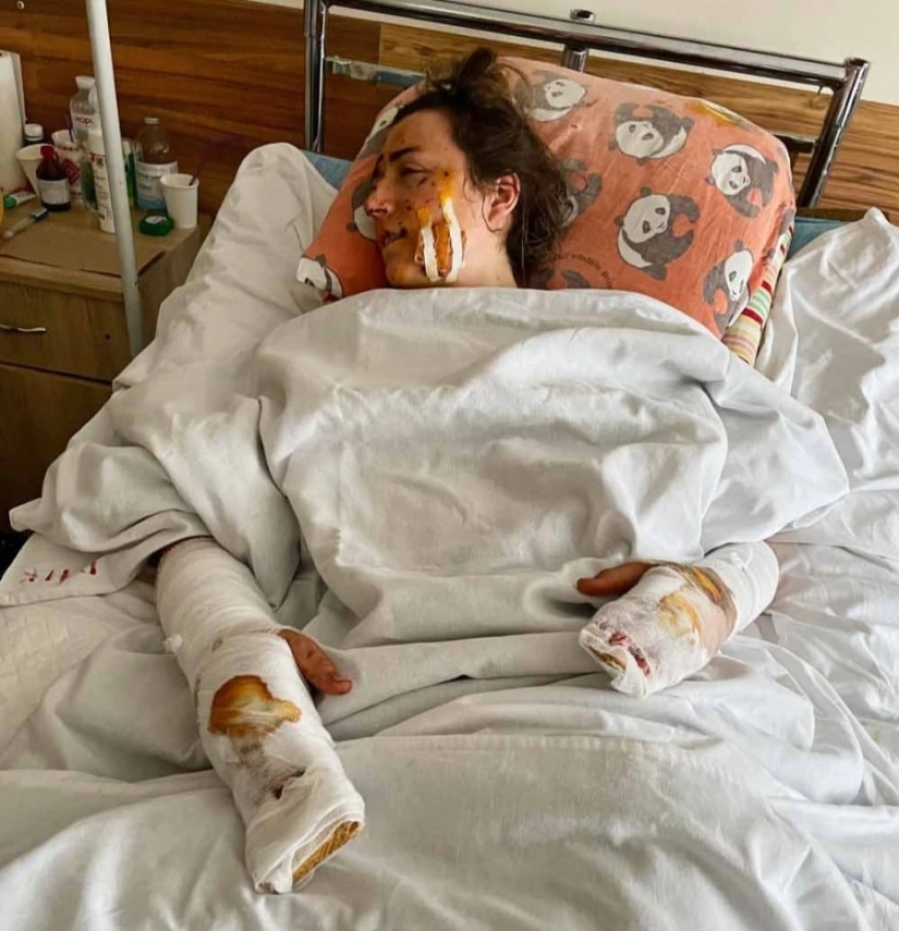 Los recién casados, que llegaron a los Cárpatos desde Gran Bretaña, fueron volados por un proyectil de la Primera Guerra Mundial Los recién casados, que llegaron a los Cárpatos desde Gran Bretaña, fueron volados por un proyectil de la Primera Guerra Mundial