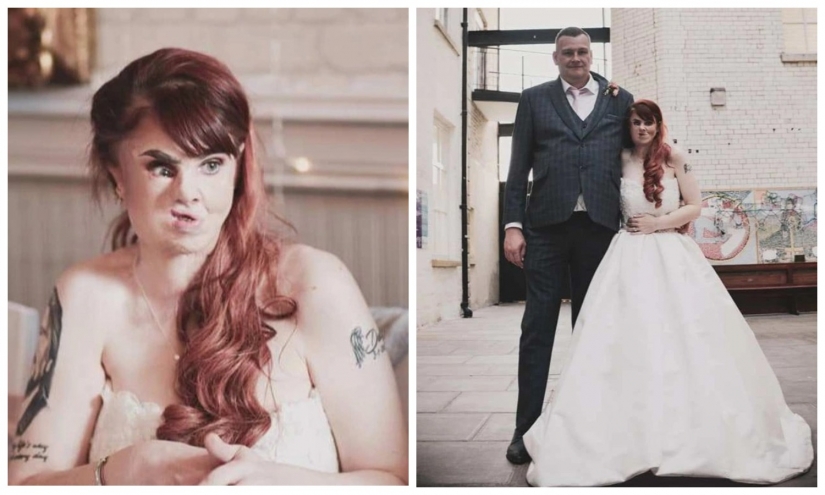 Love looks at the heart: how an Irish woman with a disfigured face found her female happiness