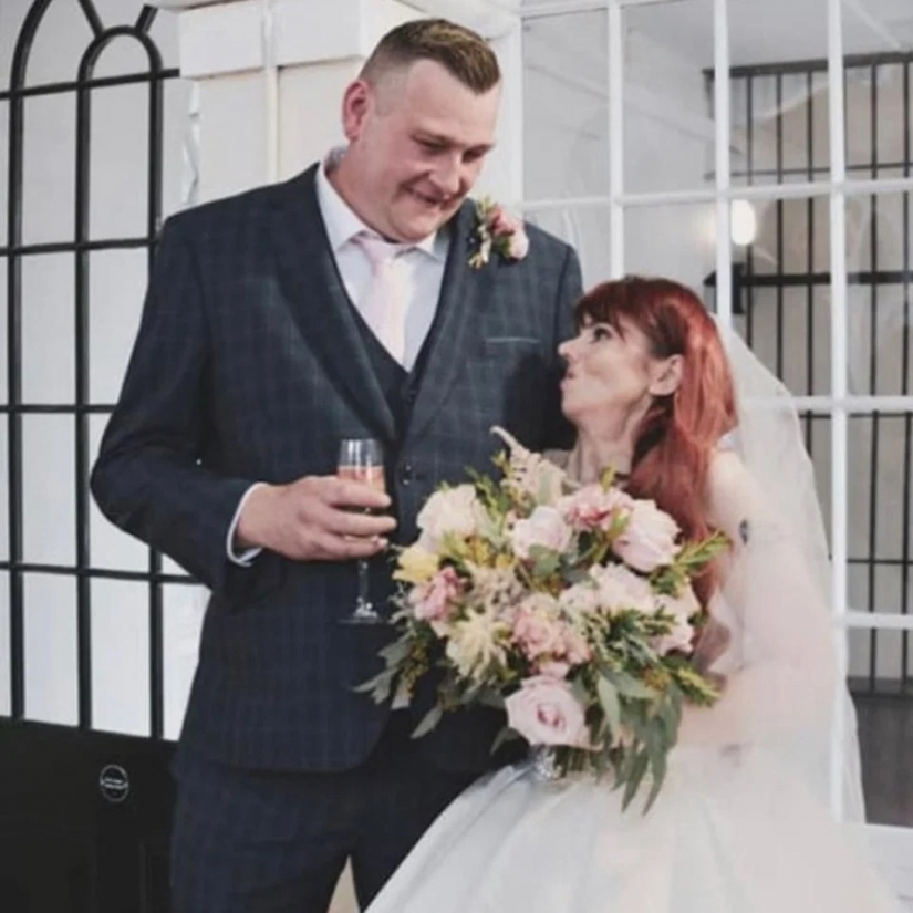 Love looks at the heart: how an Irish woman with a disfigured face found her female happiness