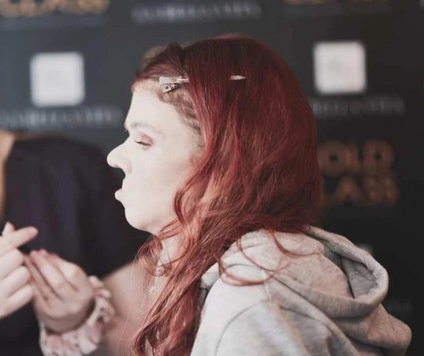 Love looks at the heart: how an Irish woman with a disfigured face found her female happiness