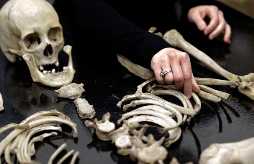 Man of parts: how much is our body, disassembled donor organs Man of parts: how much is our body, disassembled donor organs