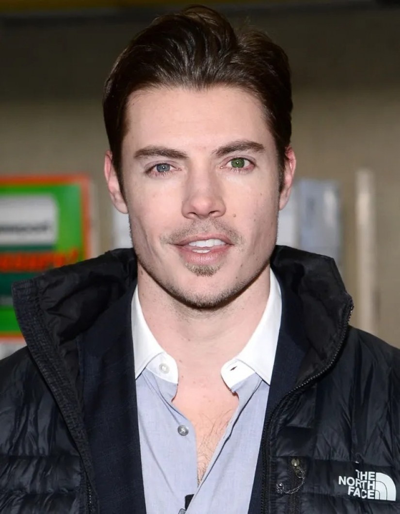 Mila Jovovich and 9 other celebrities with multicolored eyes Mila Jovovich and 9 other celebrities with multicolored eyes