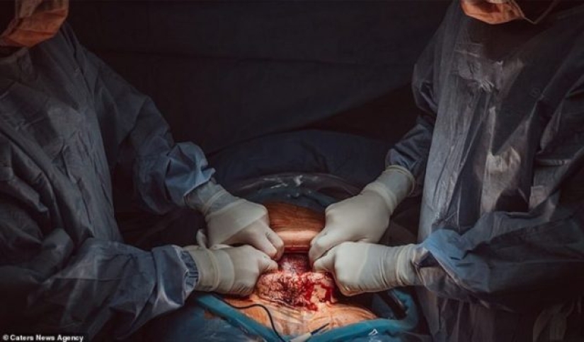 Miracle of births: winners of the international Birth Photography Awards this year captured the emotions and the first seconds of life in all their original beauty (18 +)