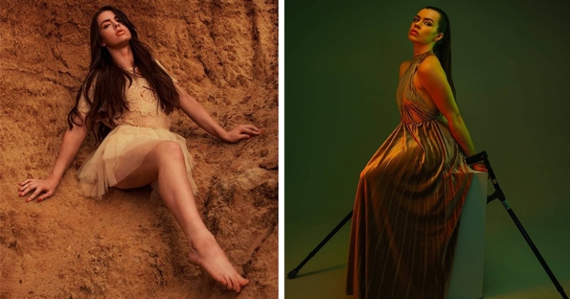 Model who lost her leg to cancer as a child is accused of simulation Model who lost her leg to cancer as a child is accused of simulation