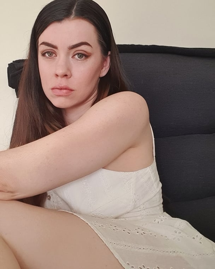 Model who lost her leg to cancer as a child is accused of simulation Model who lost her leg to cancer as a child is accused of simulation