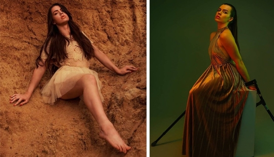 Modelo que perdió su pierna por cáncer cuando era niña es acusada de simulación