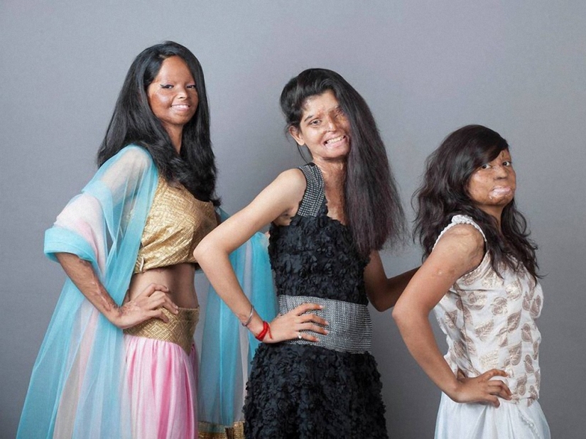 Modelos de India mutilados con ácido