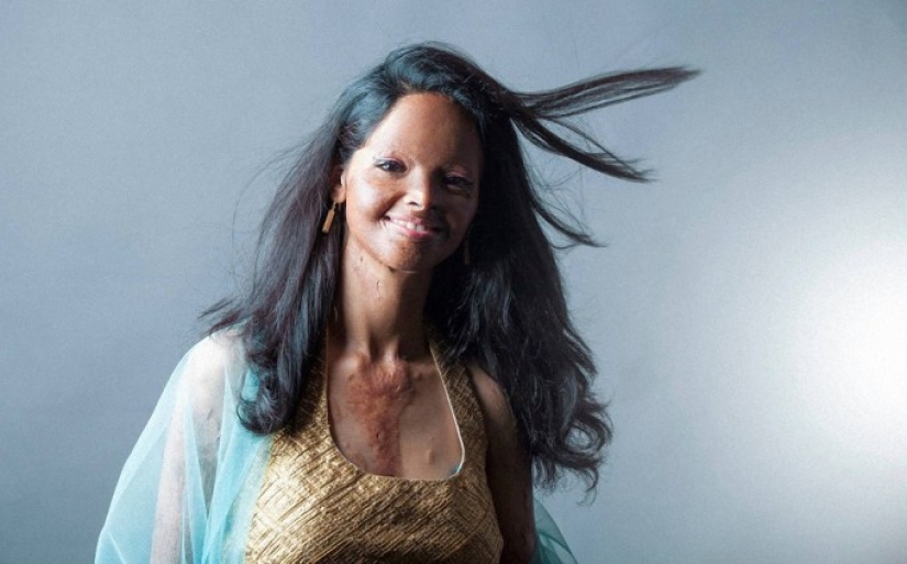 Modelos de India mutilados con ácido