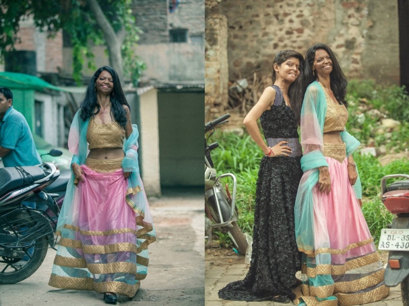 Modelos de India mutilados con ácido