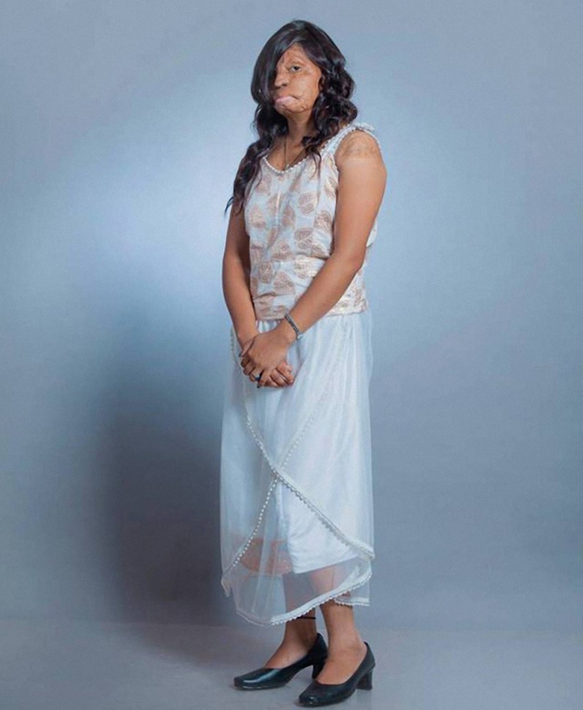 Modelos de India mutilados con ácido